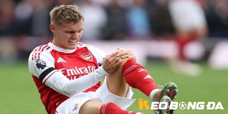 Arteta tiết lộ về chấn thương mới của Odegaard & Biến Động Kèo Arsenal
